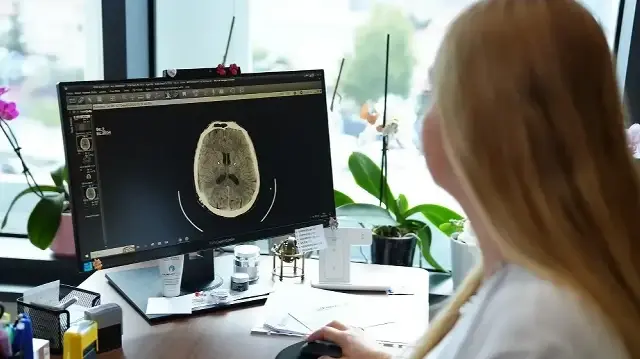 kume bas agrisi nedir belirtileri nelerdir uzmanindan onemli uyarilar VaxXgekg.webp